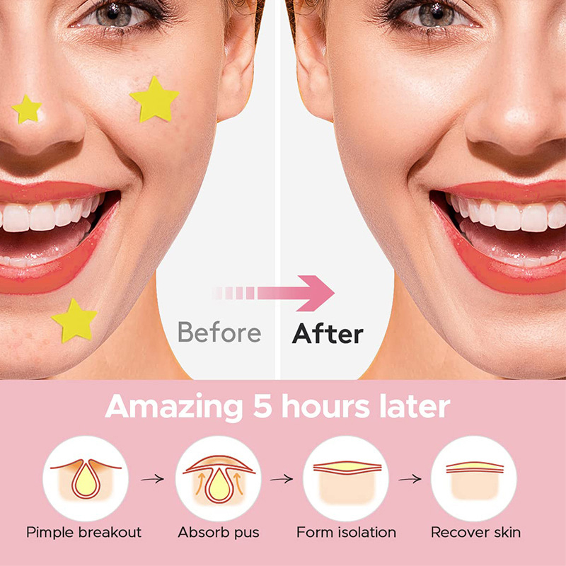 600 ピース/セットスターにきびパッチにきびカラフルな目に - Skincare Acne のレビューと価格